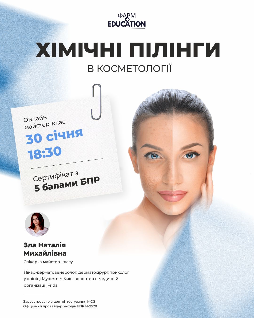 30 січня хімічні піліинги